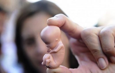 К чему снится аборт – к зачатию и родам ? основные толкования к чему снится аборт: молодой девушке, женщине, мужчине